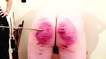 Double caning sm